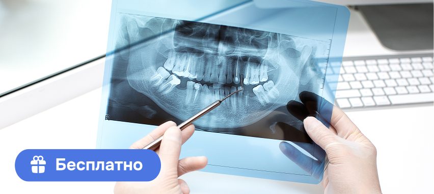 Получить план лечения зубов бесплатно